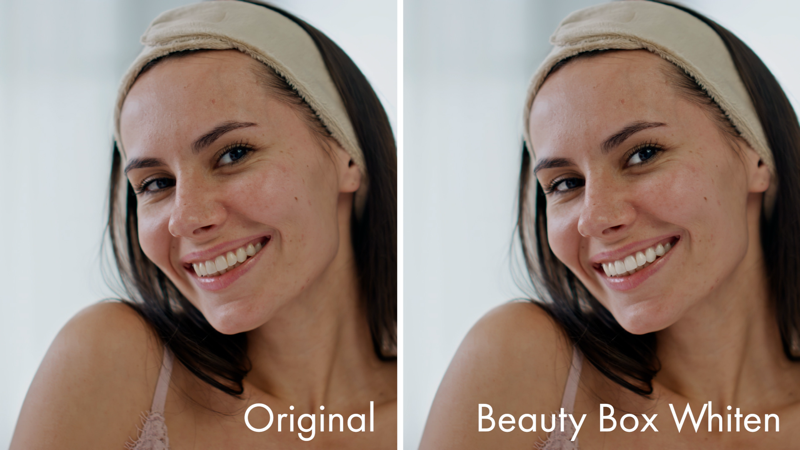 Beauty Box Whiten